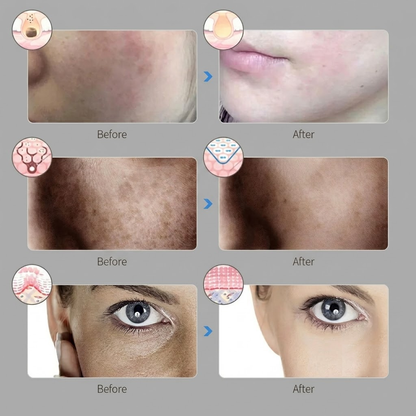 7-Color Light Therapy Mask